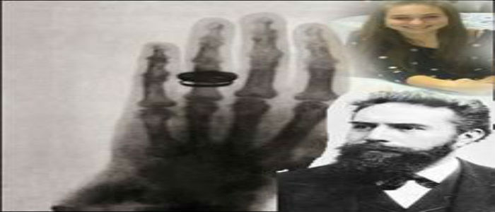 Invention of X-rays by Morgan Zachary